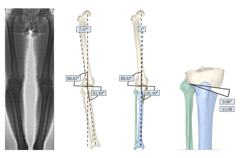 Images courtesy of Prof. Dr. Jan Victor, UZ Gent, Belgium